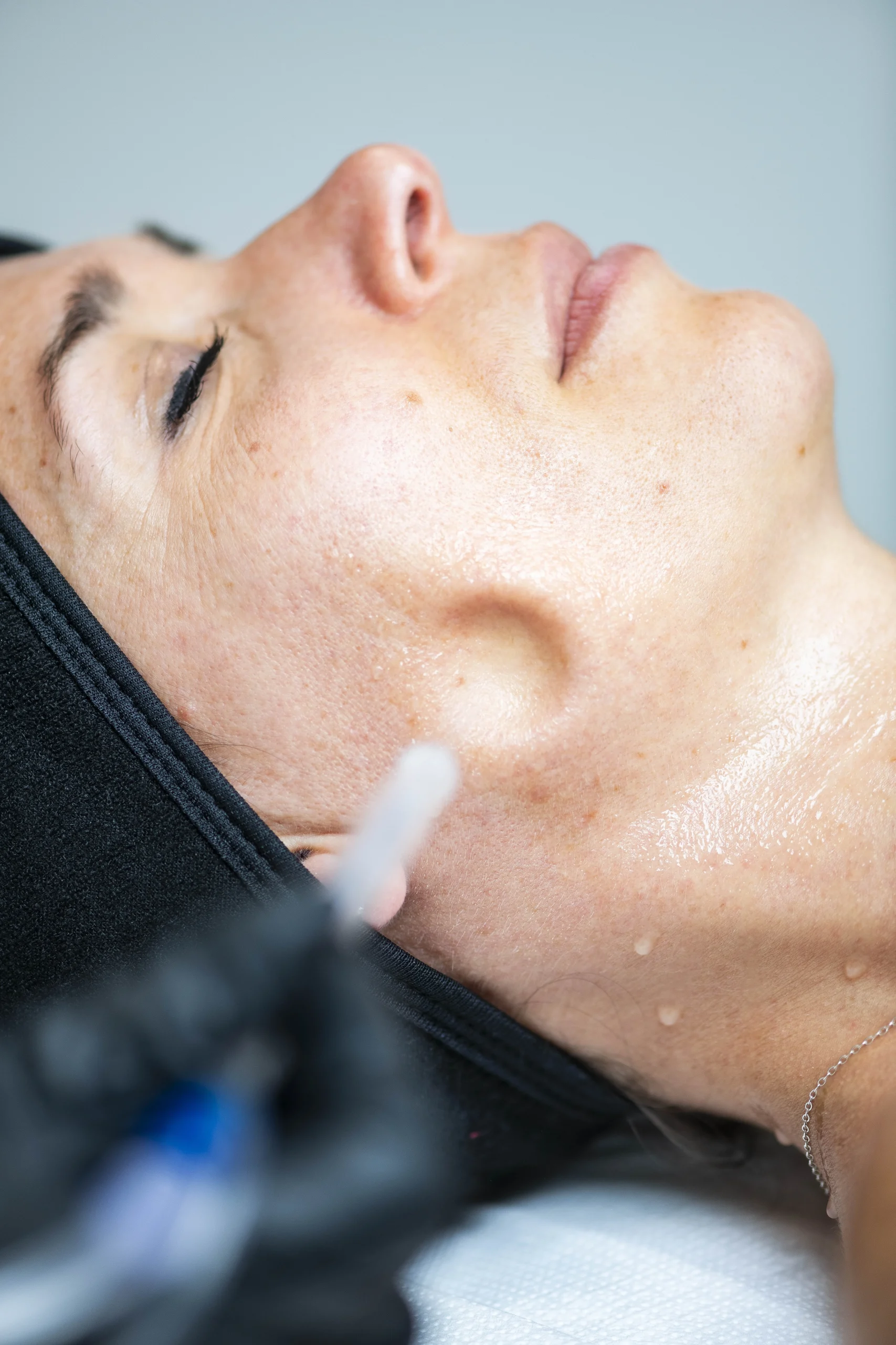 Soin anti-âge jetpeel